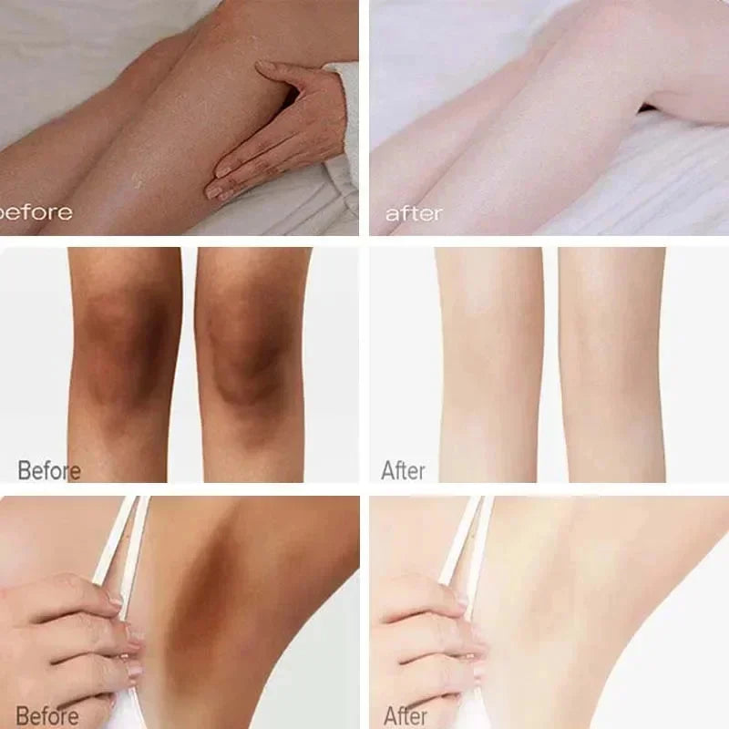 Whitening Cream For Dark Skin Underarm Bleaching Armpit Lightening And Intimate Area Woman Moisturizer Korean Skin Care Products