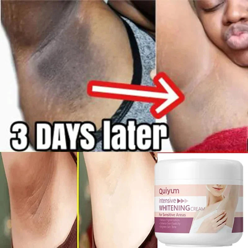 Whitening Cream For Dark Skin Underarm Bleaching Armpit Lightening And Intimate Area Woman Moisturizer Korean Skin Care Products